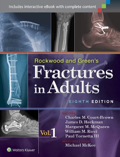  Fractures in Adults 